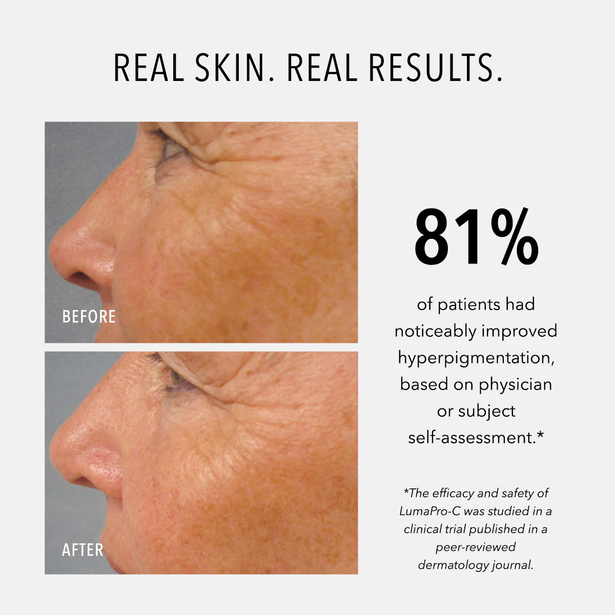 LumaPro-C Serum - Image 3