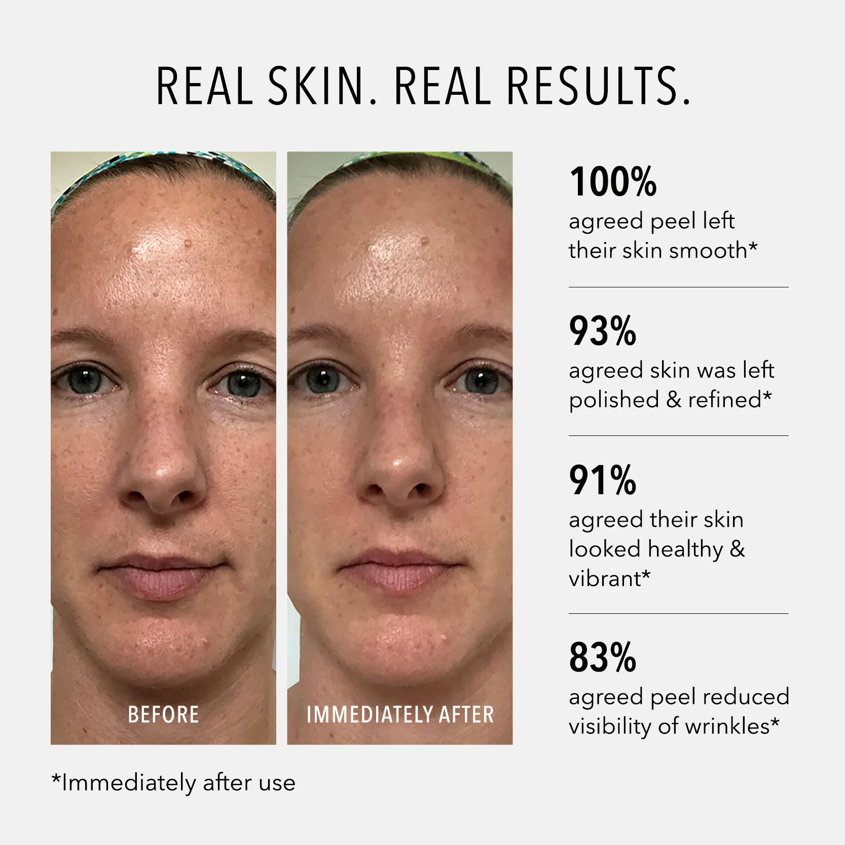 Polish & Plump Face Peel - Image 3