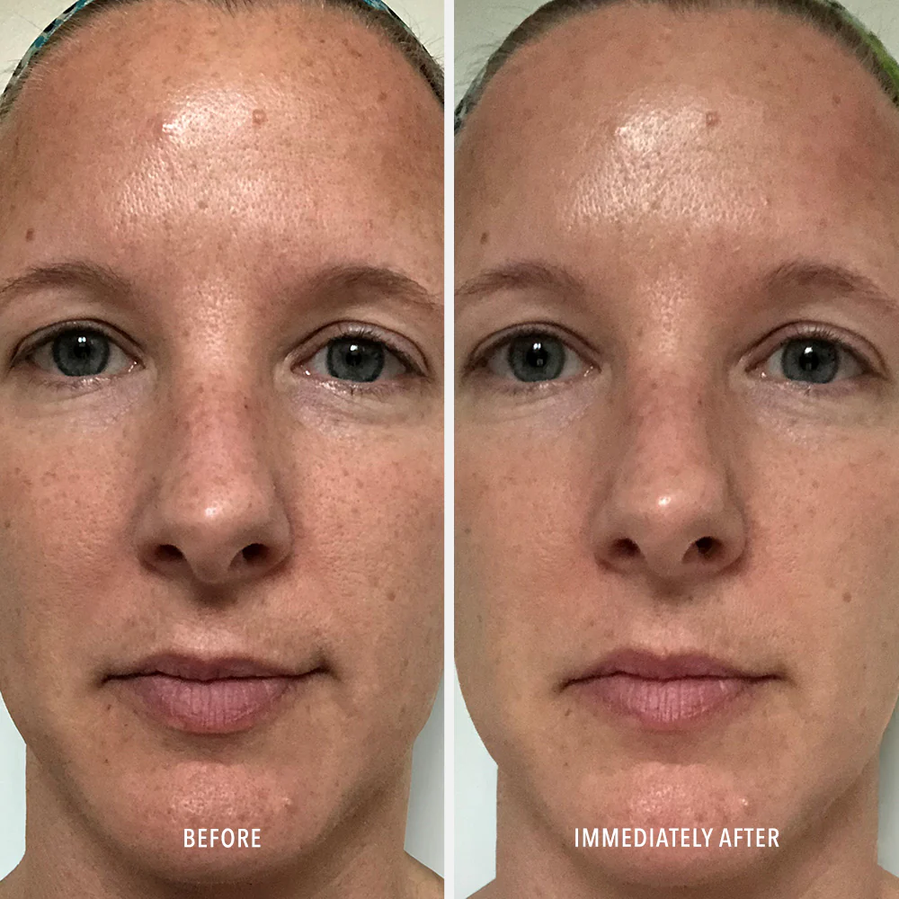 Polish & Plump Face Peel - Image 4