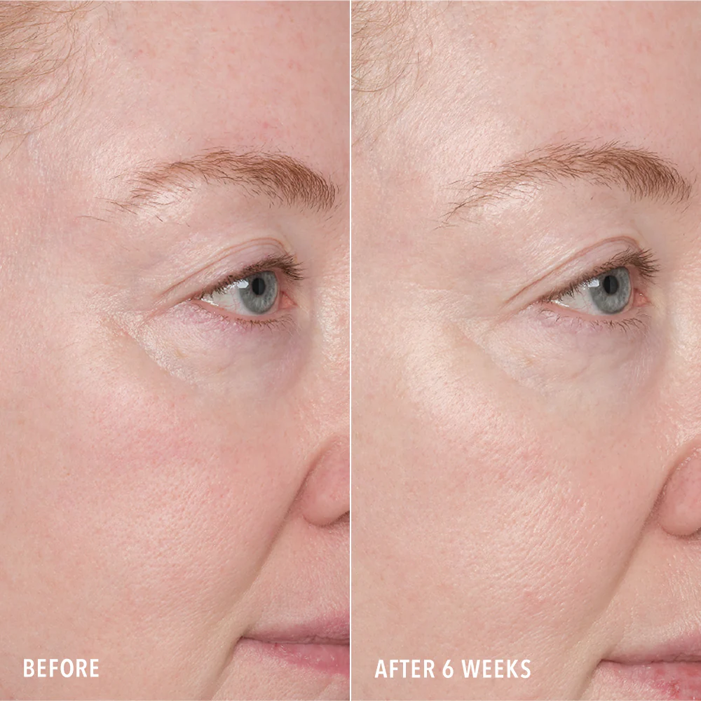 Resurface and Repair Peptide Pads - Image 3
