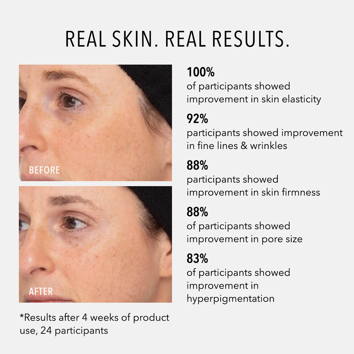 Retinol Routine Booster - Image 5