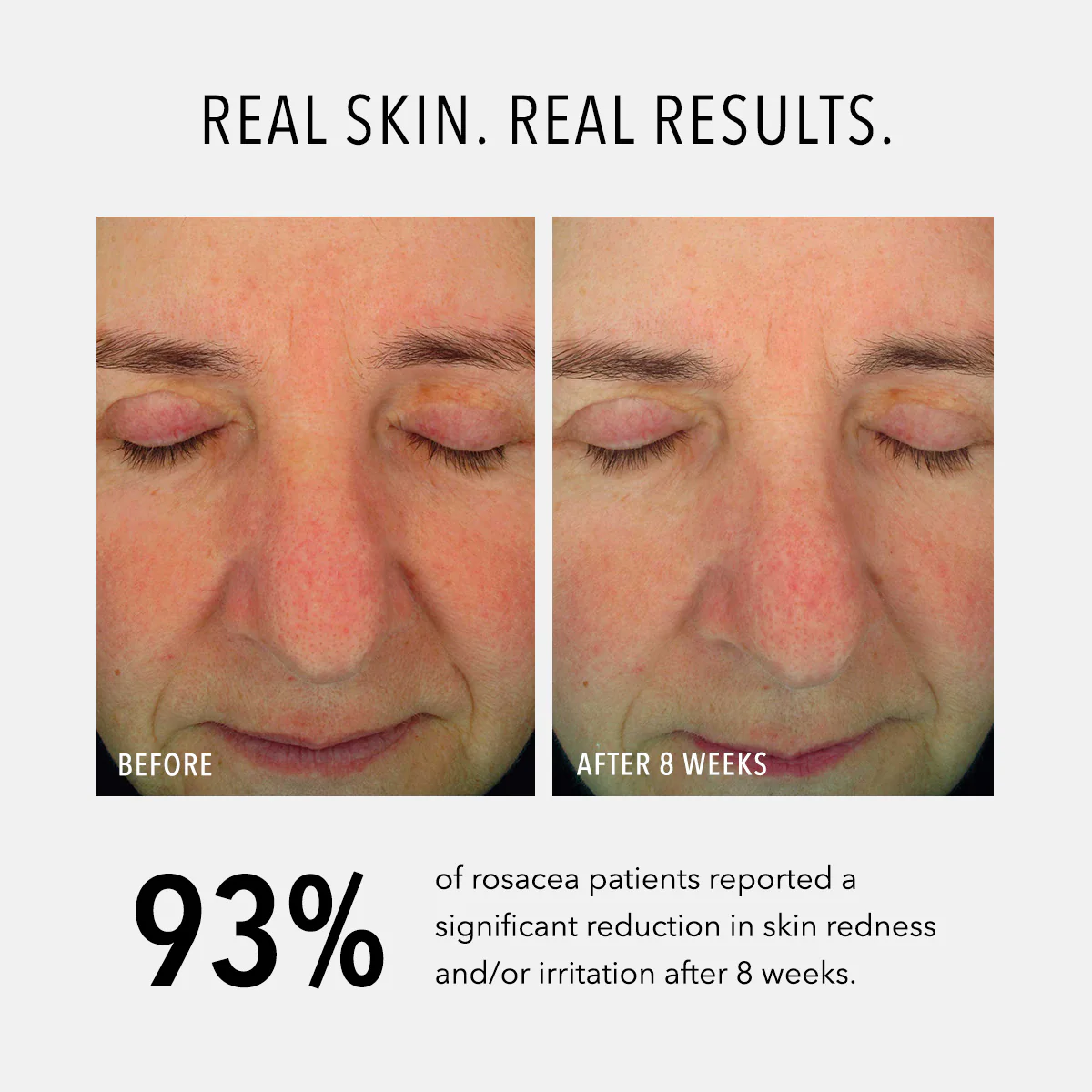 Soothing Serum - Image 3