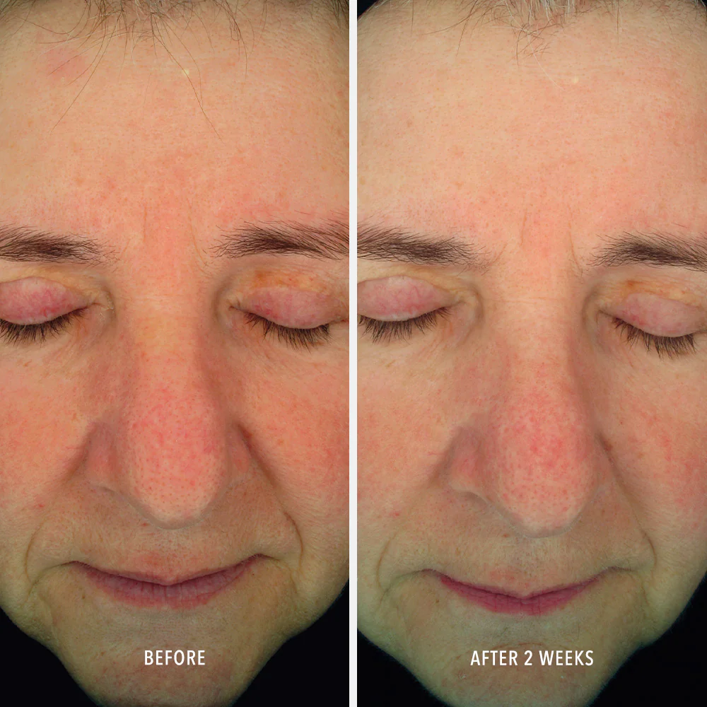 Soothing Serum - Image 4