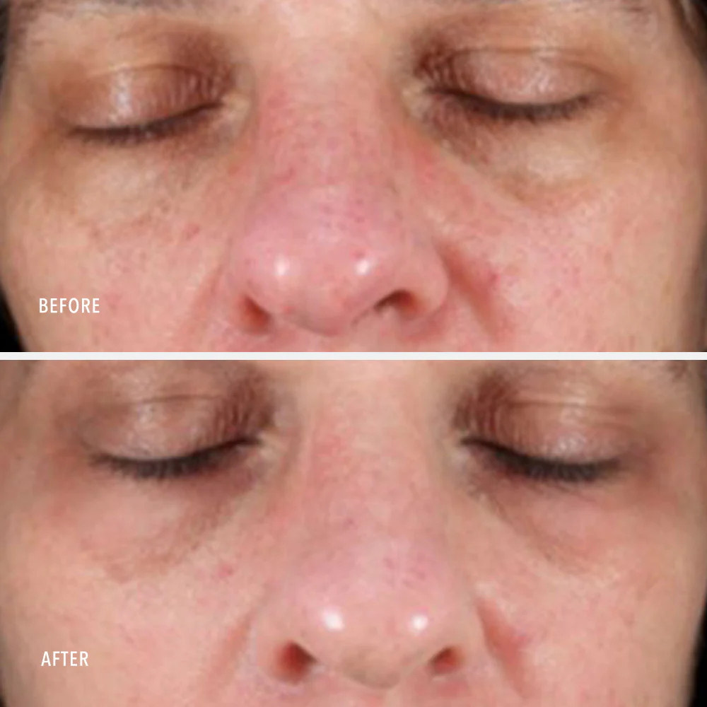 Travel-Size Collagen ReActivate PM - Image 4