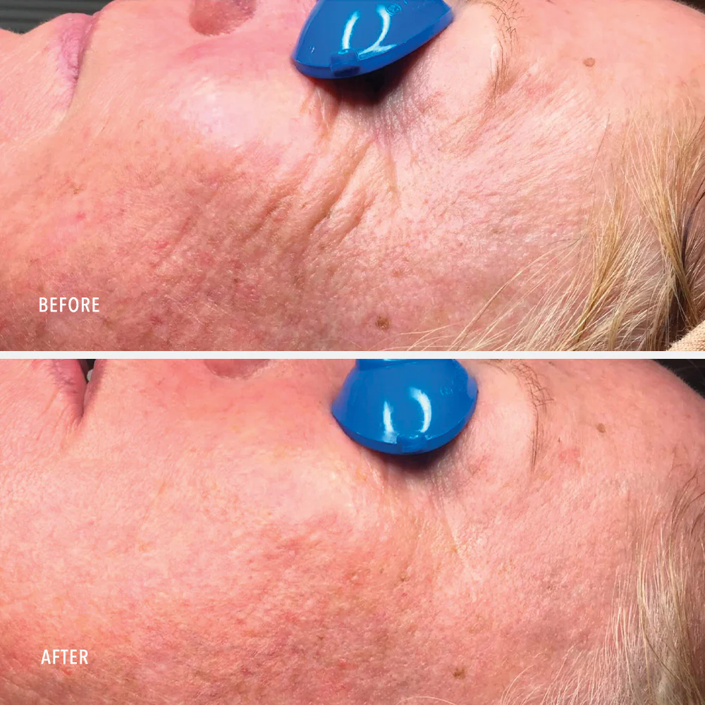 Travel-Size Collagen ReActivate PM - Image 5