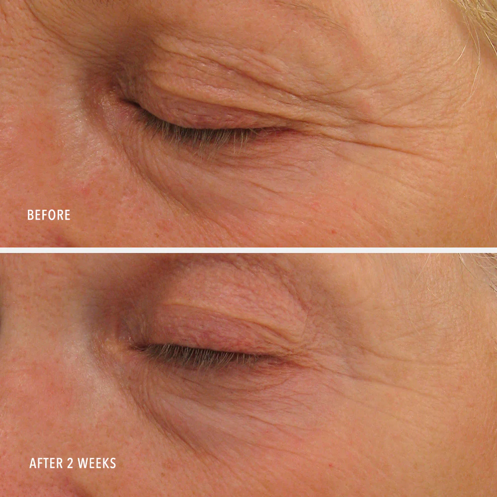 Travel-Size Eye Authority - Image 4