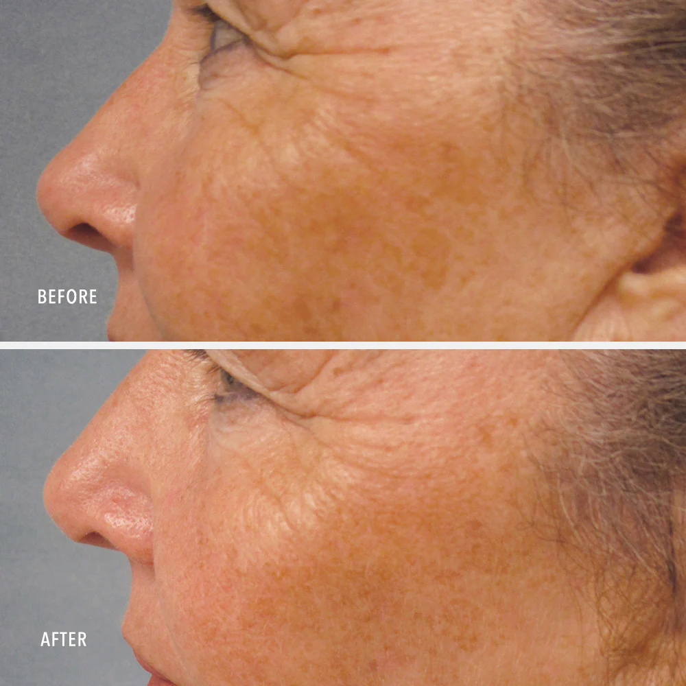 Travel-Size LumaPro-C Face Serum - Image 4