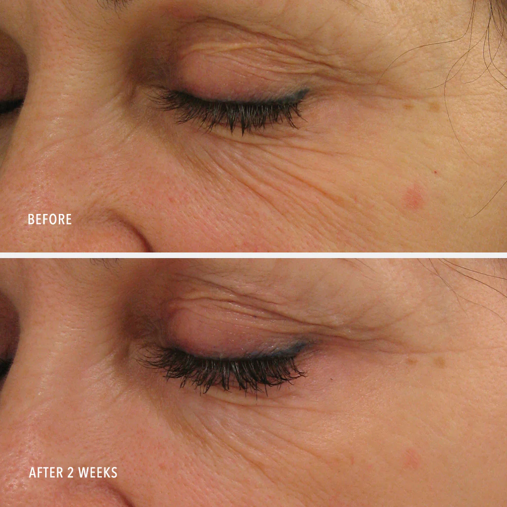 Travel-Size Power Lift Face Moisturizer - Image 4